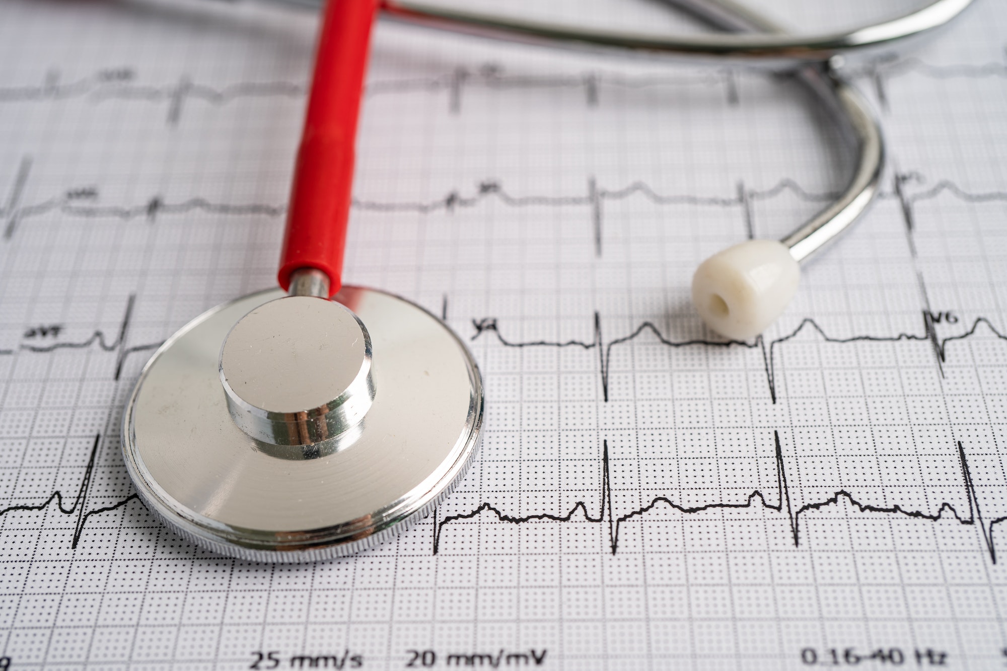 Stethoscope on electrocardiogram with red heart, heart wave, heart attack, cardiogram report.